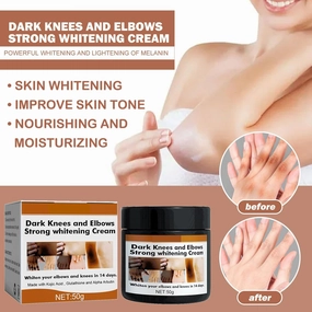 2025 new 2pcs 50ml Crema Para Manchas Oscuras En La Cara, Day & Night Cream for Face Moisturizer Cream, Adecuado para varias áreas como cara, axilas, cuello, zona privade
