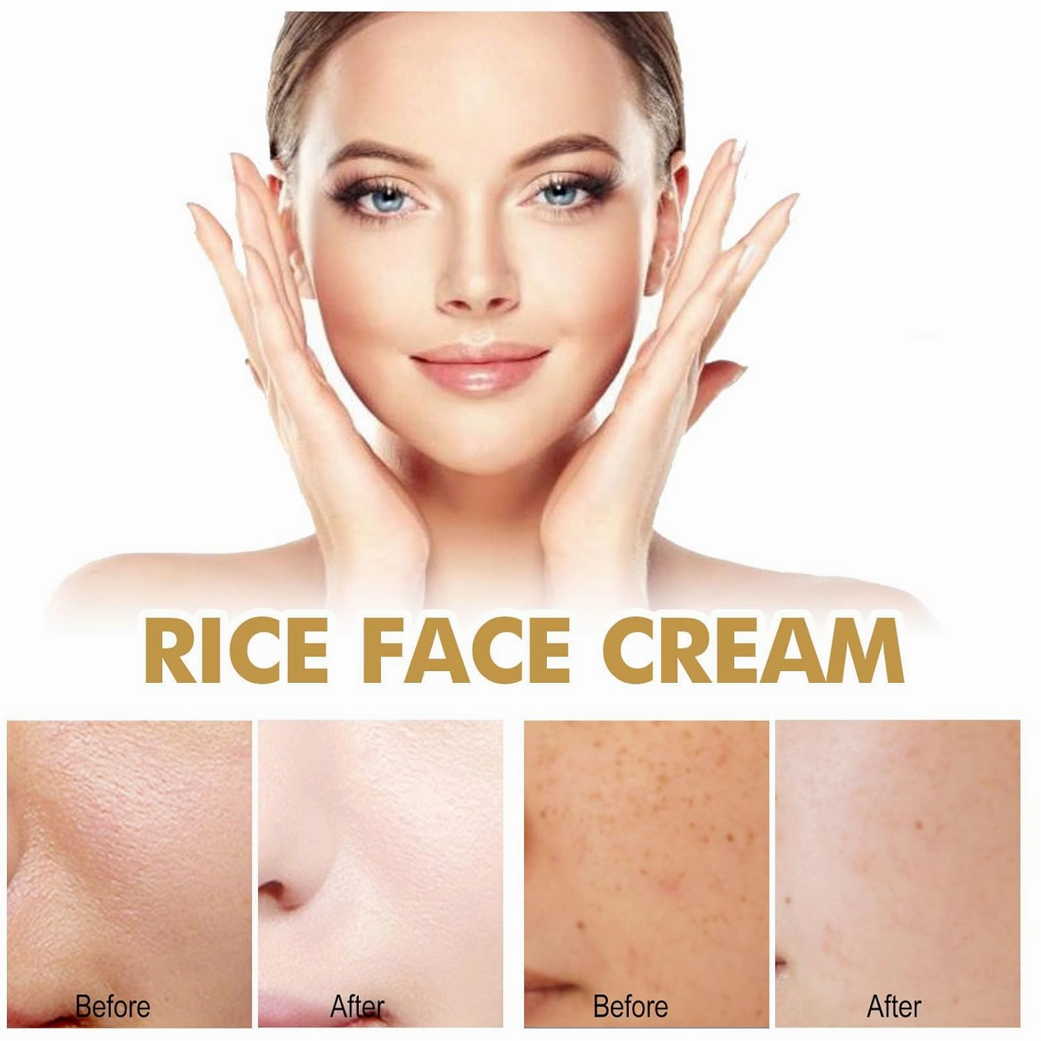 2026 new Crema Para Manchas Oscuras En La Cara,Day & Night Cream for Face Moisturizer Cream, Adecuado para varias áreas como cara, axilas, cuello, zona privade,50ml (3pcs)