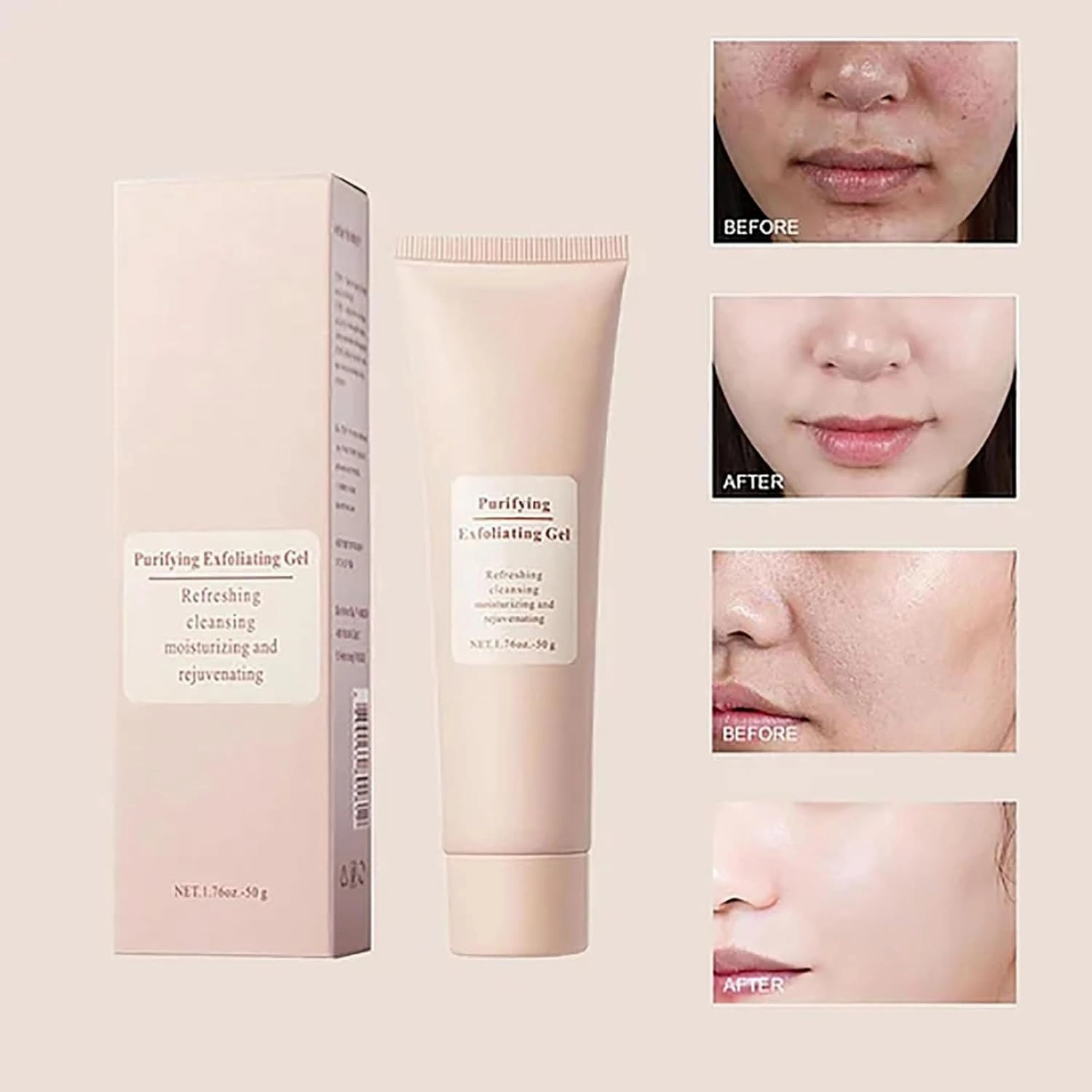 Dpoiex Exfoliating Gel, Purifying Enzymes Exfoliating Gel, Gentle Body Scrubber Moisturizing Gels, Deep Cleansing Face and Body Exfoliatings Scrub Gels for All Skin (3Pcs, s)