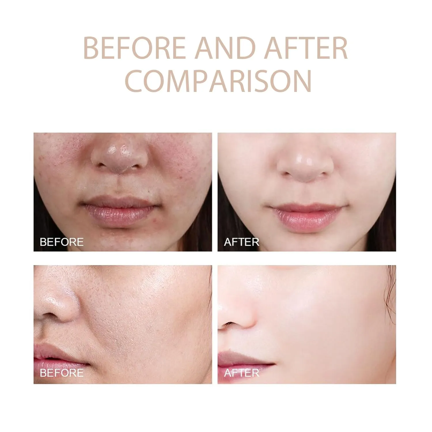 Glow Goddess Exfo-liating Gel,Facial Exfoliator Scrub,Purifying Enzymes Exfo-liating Gel,Purifying Exfoliating Gels For Dark Spots (2PCS)