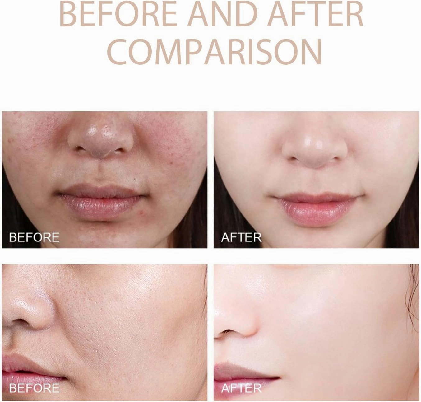 Purifying Exfoliating Gel - Exfoliating Gel,Cream, Gel, Face and Body Exfoliating Scrub Gel for All Skin (3 PCS)