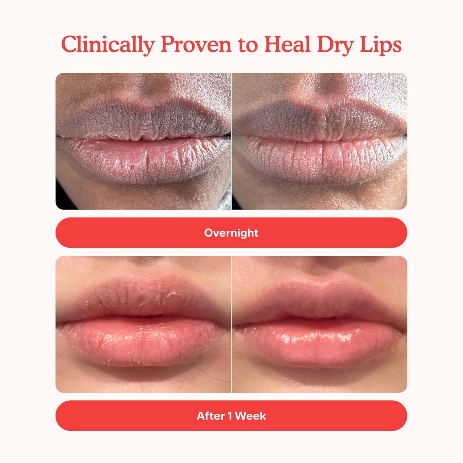 Tower 28 LipSoftie Hydrating Tinted Lip Treatment Balm, Moisturizing Lip Mask for Chapped Lips - Ube Vanilla Flavor, Sheer Burgundy Gloss